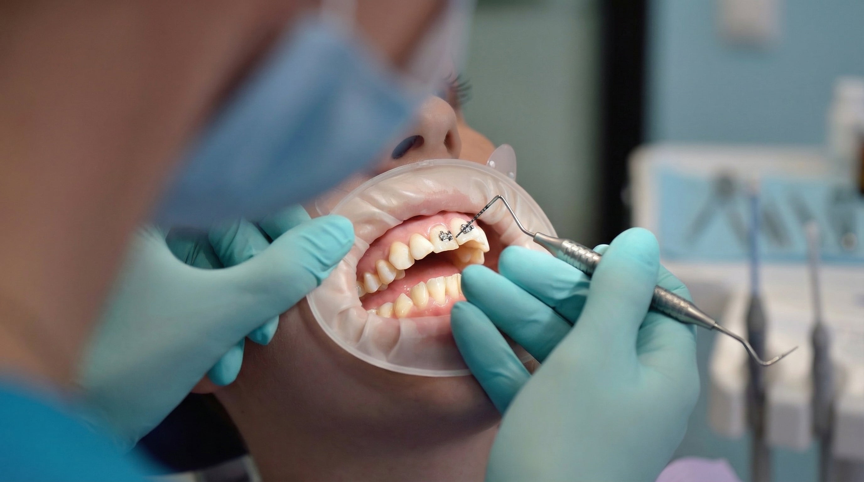 Ce que votre dentiste ne vous dit pas en consultation (mais pense très fort)